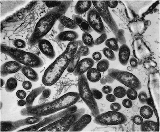 FIGURE 2-11 Electron micrograph of Candidatus Liberibacter sp. in the phloem of infected citrus tree.