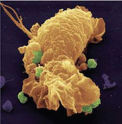 FIGURE WO-4-8 False-colored scanning electron micrograph of a human phagocyte and gonococci (green).