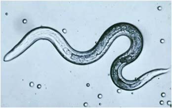 FIGURE WO-6-18 Parasitic roundworm associated with Toxocariasis (larvae).