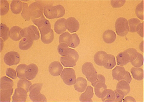 FIGURE 5-3 Ring forms of Babesia microti in human blood smear (× 1,000).